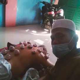 Bekam Sunnah bang Bashir medan