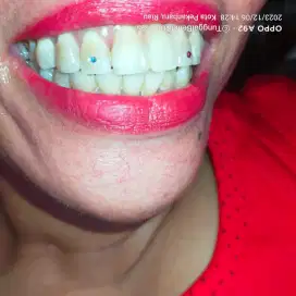Diamond gigi berlian gigi