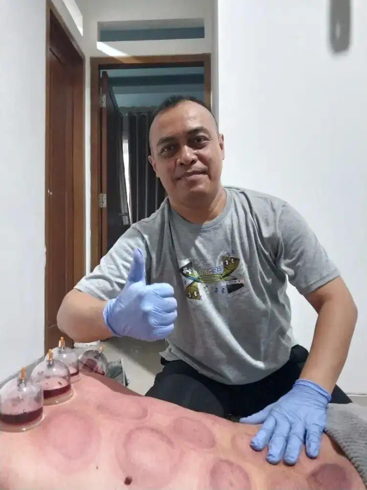 Bekam dan Gurah Hidung untuk kesehatan .