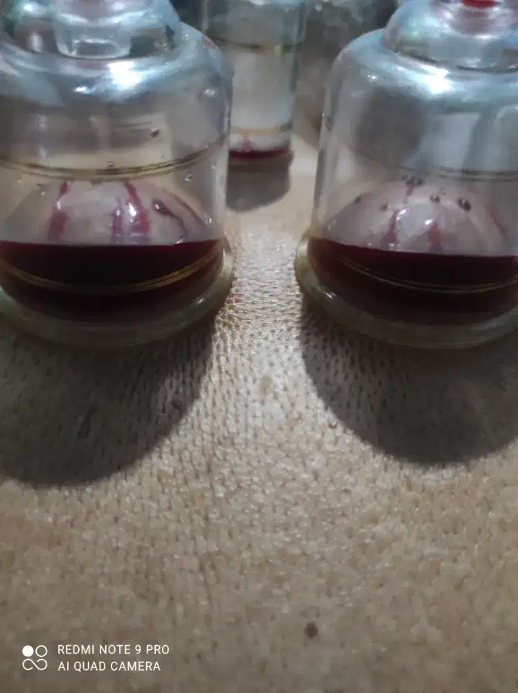 Bekam basah pangilan