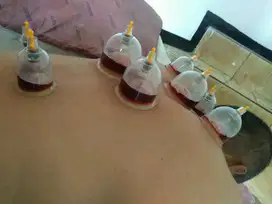 Terapi bekam bandung panggilan