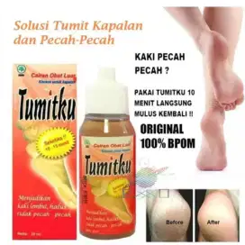 Tumitku untuk kaki