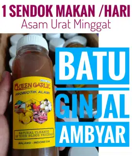 Asam Urat, Batu Ginjal, Batu Empedu