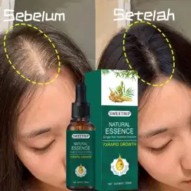 SERUM RAMBUT RONTOK & SHAMPO PENUMBUH RAMBUT CEPAT