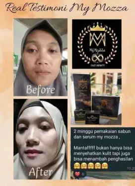 Loker reseller perawatan kulit kecantikan mymozza
