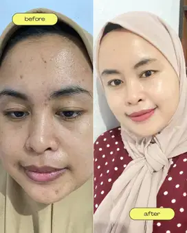 Skincare pemutih wajah BPOM