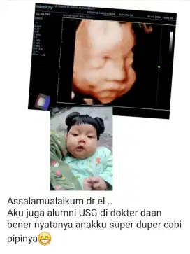 USG 4D mindray seken softcopy video via wifi