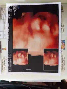 Mencari pengasuh bayi 11 bulan