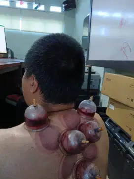 Terapis bekam repleksi