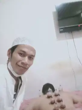 Pijat dan bekam