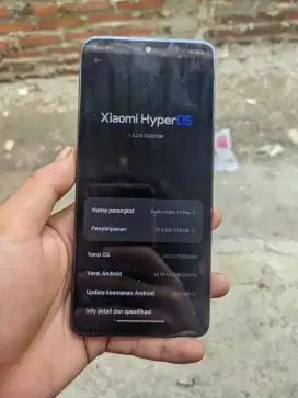 Xiomi redmi Not 11 Pro 4G