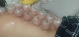 Bekam panggilan