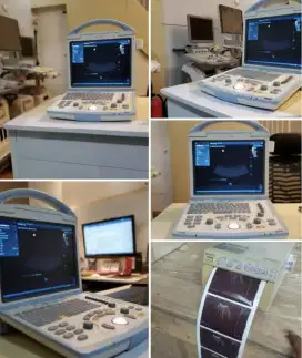 Usg 2D DP 10 mindray
