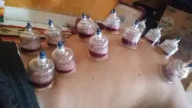 terapi bekam sunah nabi