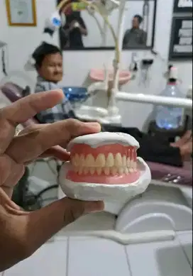 pasang Gigi palsu valplast