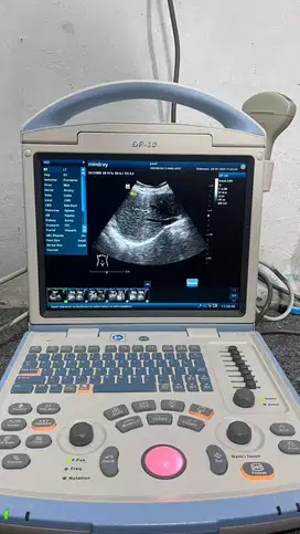 Usg 2D mindray dp 10