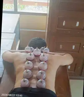 Bekam di rumah home care ajah