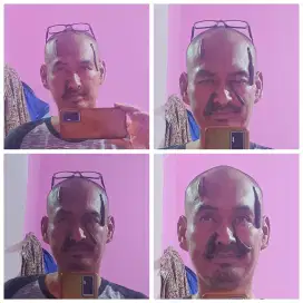 Terapi lintah untuk menyembuhkan semua penyakit