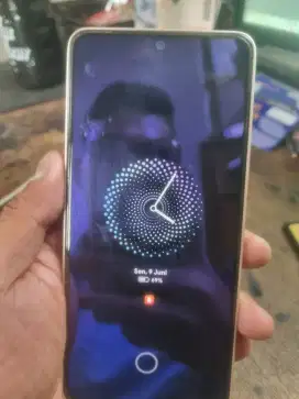 Xiomi Redmi Note 13