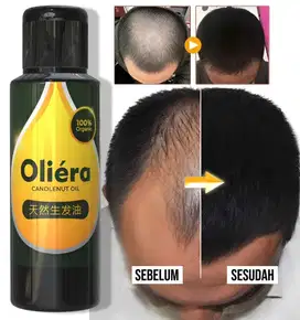 Penumbuh Rambut (GRATIS ONGKIR) Bisa COD
