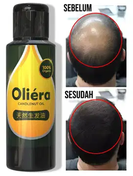 Penumbuh Rambut (GRATIS ONGKIR) Bisa COD