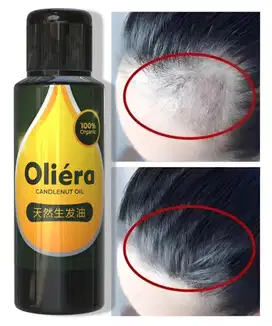 Penumbuh Rambut (GRATIS ONGKIR) Bisa COD