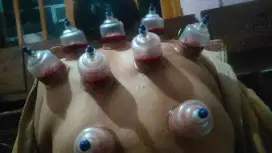 Terapi pijat kesehatan