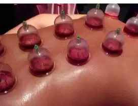 Bekam Untuk Kesehatan