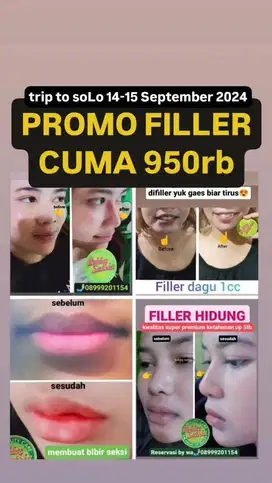 filler hidung dagu & bibir
