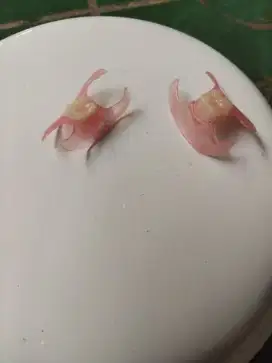 Gigi Palsu (Valplast) Satuan - Ringan, Nyaman, dan Tampak Natural!!!