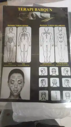 Terapi segala keluhan penyakit