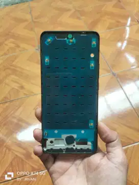 Frame Xiaomi 12T