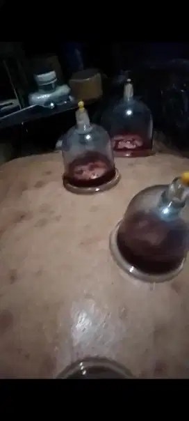 bekam panggilan layanan menjaga kesehatan