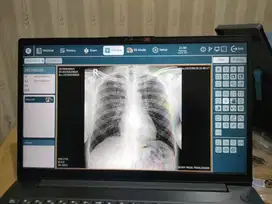 Dibutuhkan Segera Marketing Alat Radiology