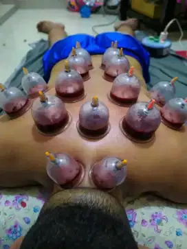 Menerima jasa bekam sudah ada sertifikat resmiiii
