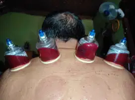 Bekam sunah SOP PBI griya sehat bintang 9 duren seribu