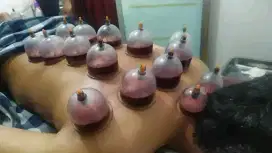 Jasa Bekam Untuk Kesehatan