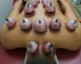 Sehat Dengan Bekam (Bersertifikat)