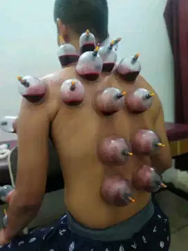Bekam full body