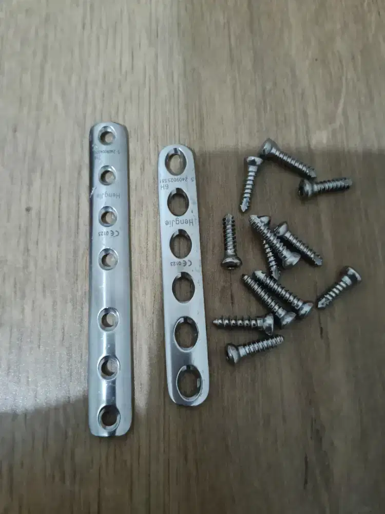 Pen untuk patah tulang tangan