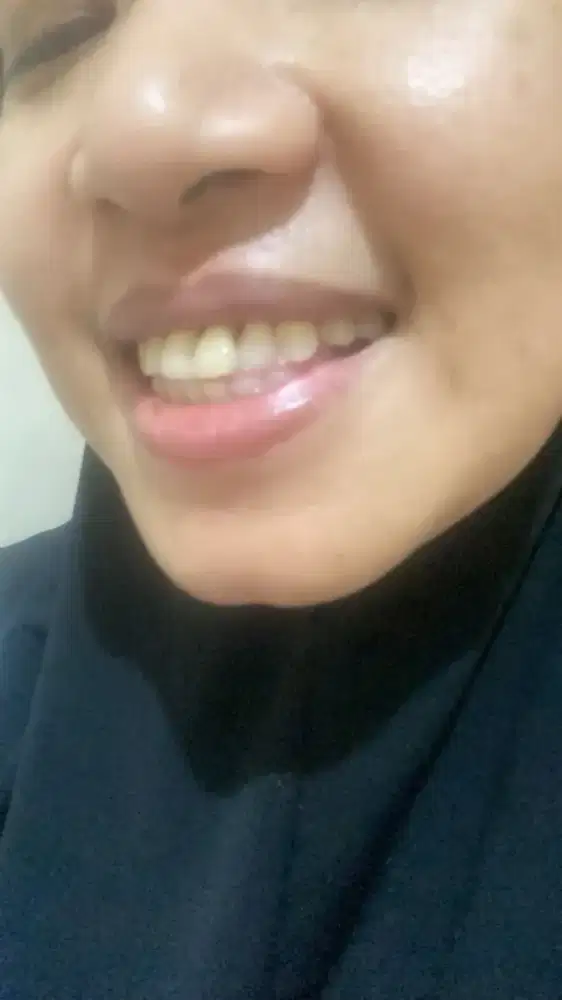 Lowongan kerja wanita