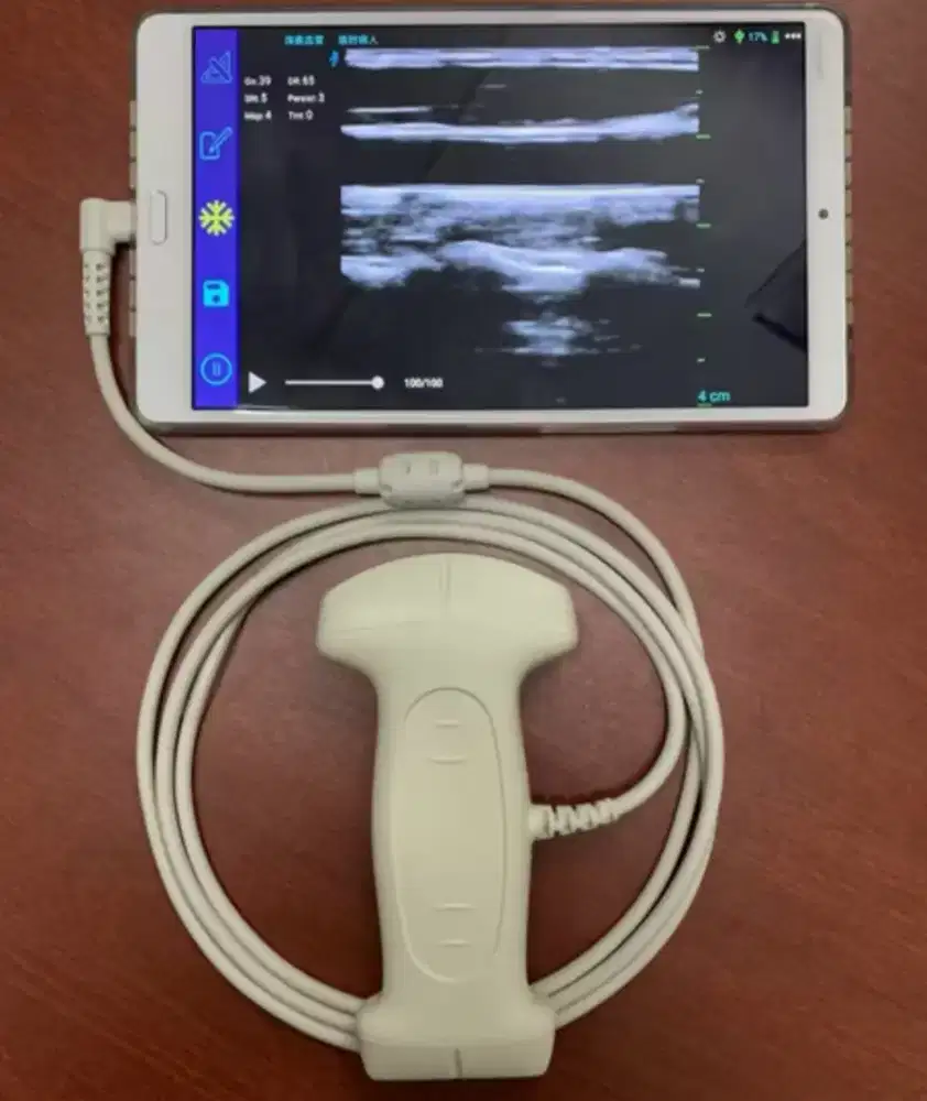 USG Mindray DP 10 dengan probe Convex