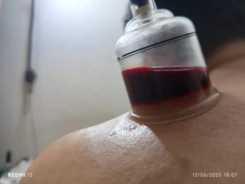 Di cari therapist berpengalaman