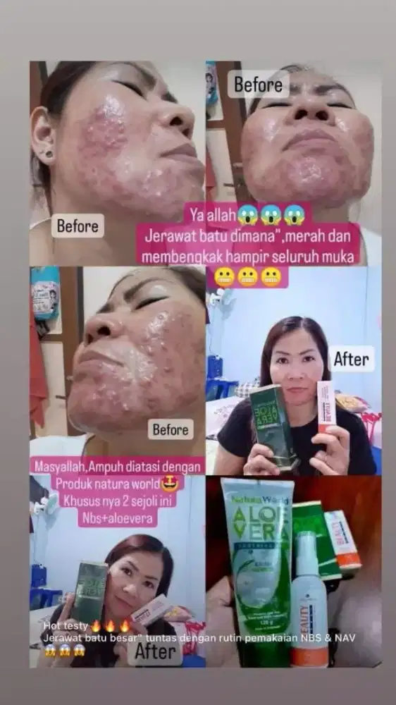 Natura beauty spray bisa untuk perawatan dan kecantikan