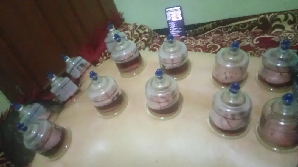 Panggilan bekam