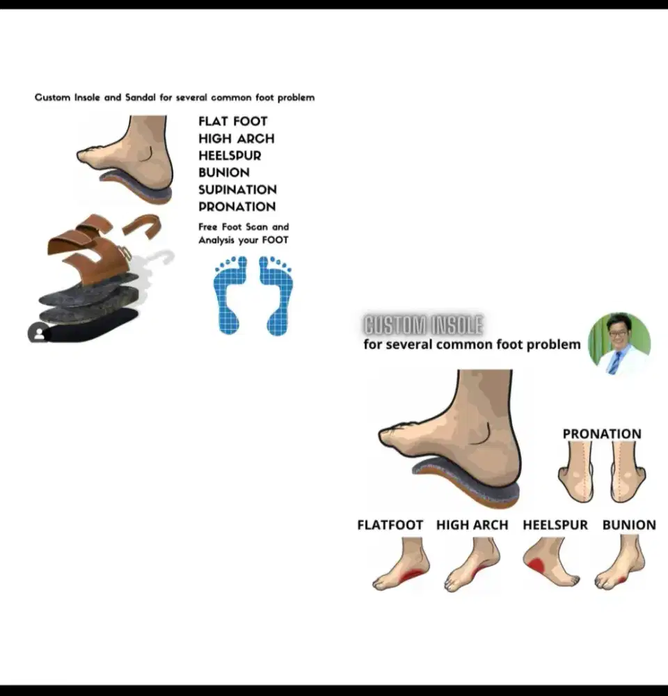 Sandal dan insole custome