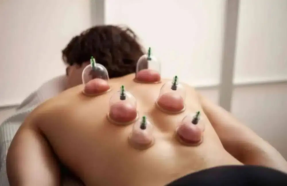 Melayani Bekam dan Rukyah