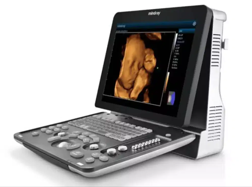 USG mindray Z60 (baru)