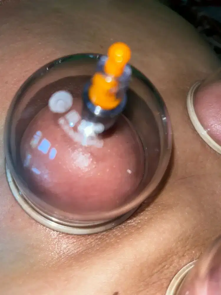 Terapis bekam dan spa