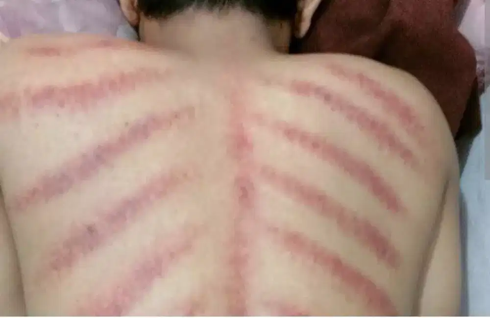 Assalamualaikum saya mau menawarkan jasa tukang kerokan sama ngurut